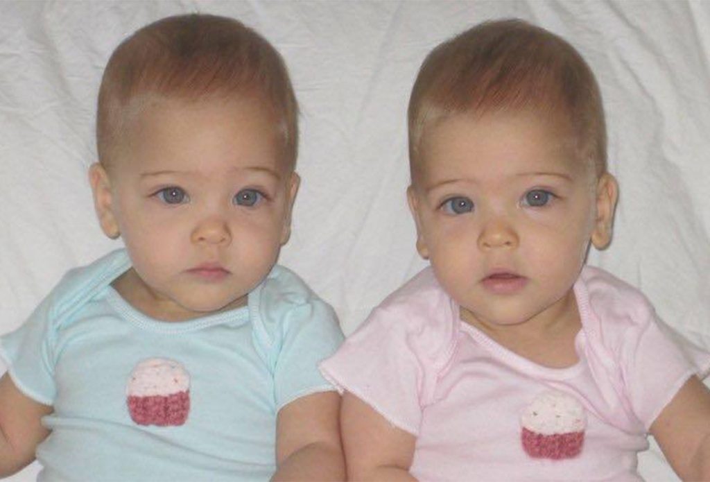 They were labelled the ‘world’s most beautiful twins’ 8 years ago -but now look what the girls look like today